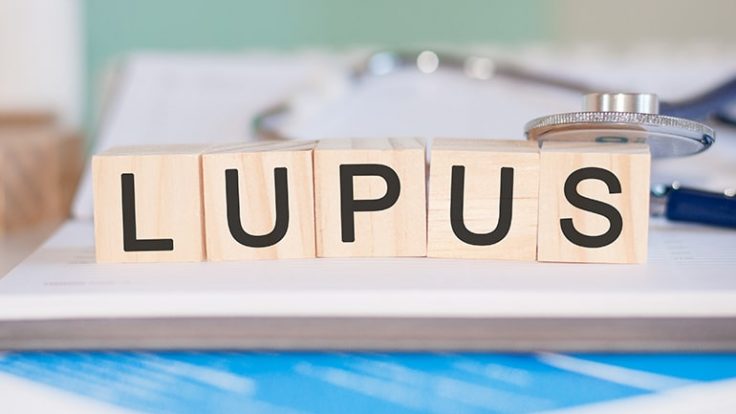 Bağışıklık Sisteminin Gardını Düşüren Hastalık; Lupus