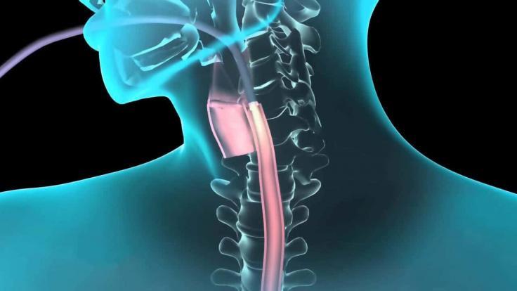ENDOSKOPİ (GASTROENTOROLOJİ)
