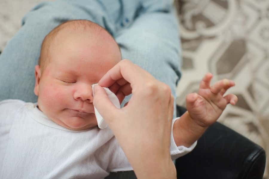 yeni doğan bebeğin gözü neden çapaklanır